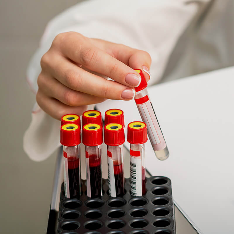 CARROSSEL-SOBRE-LURION-001